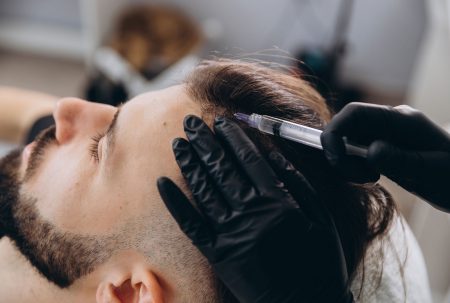 mann-erhaelt-injektion-in-die-kopfhaut-eigenbluttherapie-mit-prp-oder-prf